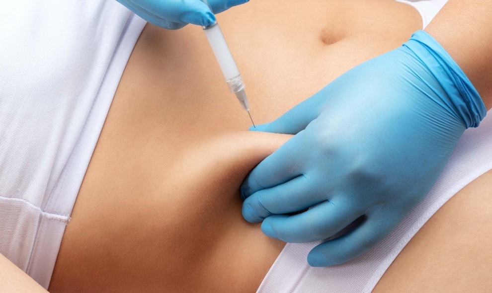 Injekční lipolýza